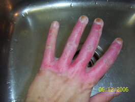 ai110.photobucket.com_albums_n83_unlisted8495_hands_100_1687.jpg ai110.photobucket.com_albums_n83_unlisted8495_hands_100_1687.jpg