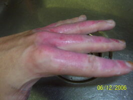 ai110.photobucket.com_albums_n83_unlisted8495_hands_100_1689.jpg ai110.photobucket.com_albums_n83_unlisted8495_hands_100_1689.jpg