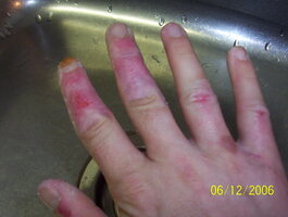 ai110.photobucket.com_albums_n83_unlisted8495_hands_100_1692.jpg ai110.photobucket.com_albums_n83_unlisted8495_hands_100_1692.jpg