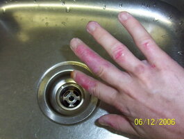 ai110.photobucket.com_albums_n83_unlisted8495_hands_100_1694.jpg ai110.photobucket.com_albums_n83_unlisted8495_hands_100_1694.jpg